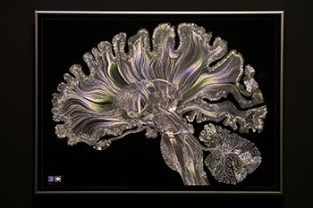 Representación de un cerebro