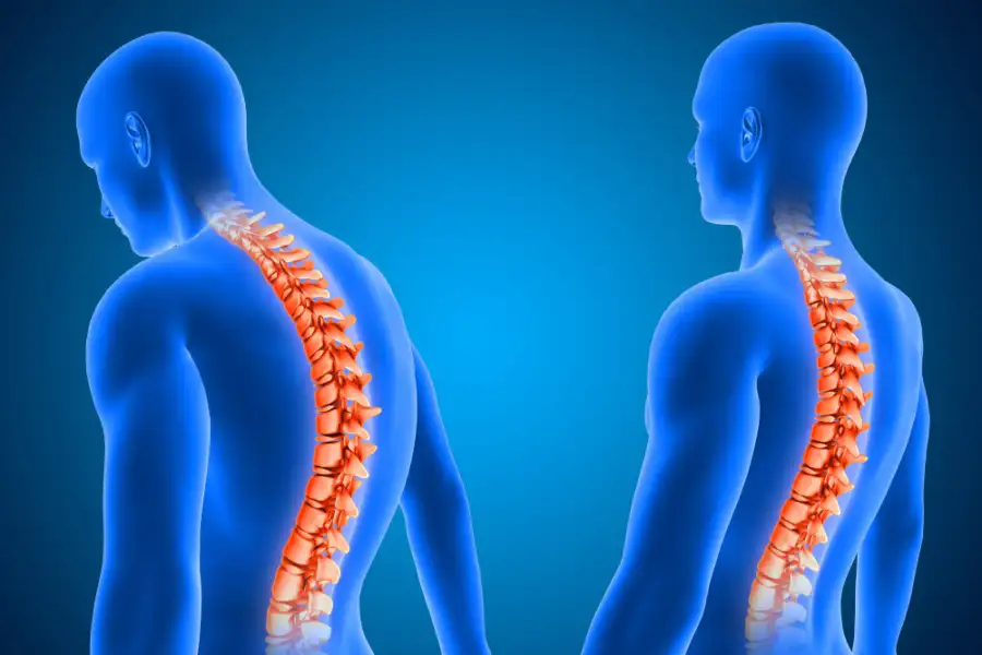 educación postural