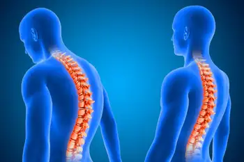 educación postural